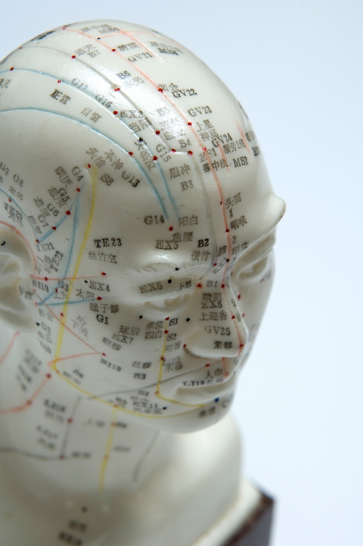Migraine watch: Keeping up with the most current research for&nbsp;acupuncture