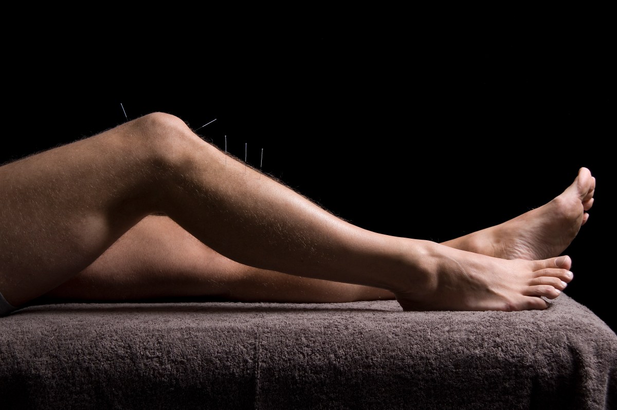 Acupuncture for muscular and joint&nbsp;pain